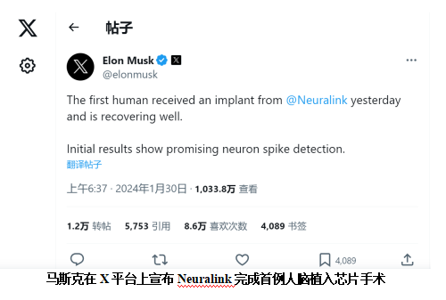 馬斯克宣布Neuralink完成首例人腦植入芯片手術(shù)